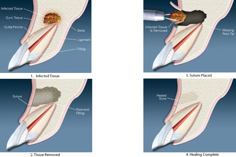 Dental Specialty Group North Toronto North York Kitchener Periodontal