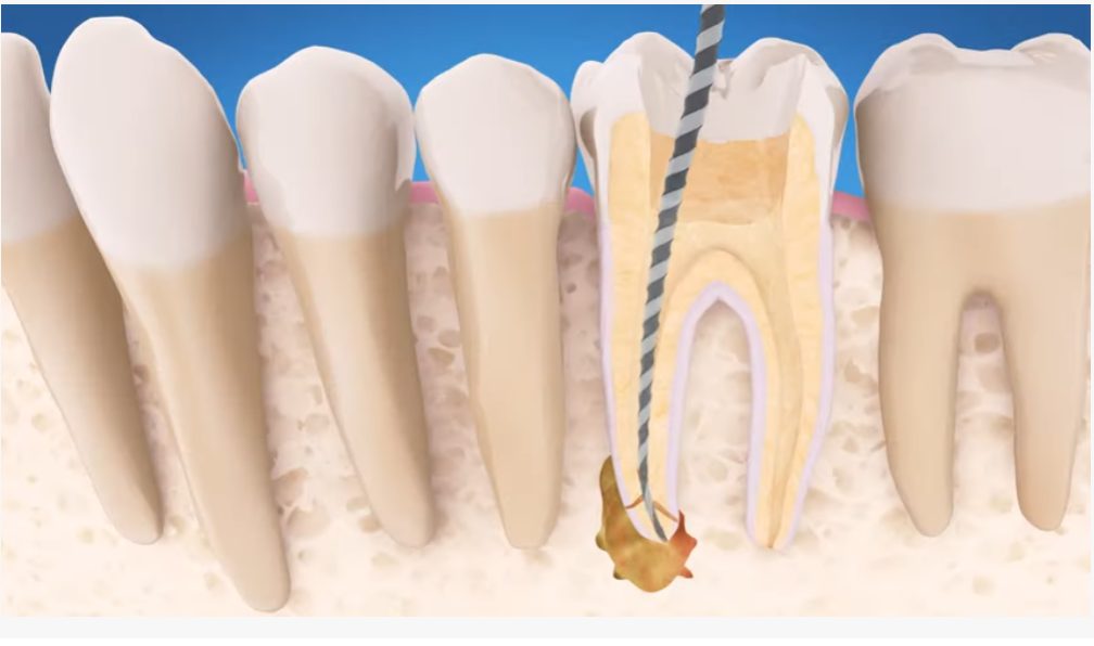 Dental Specialty Group North Toronto North York Kitchener Periodontal