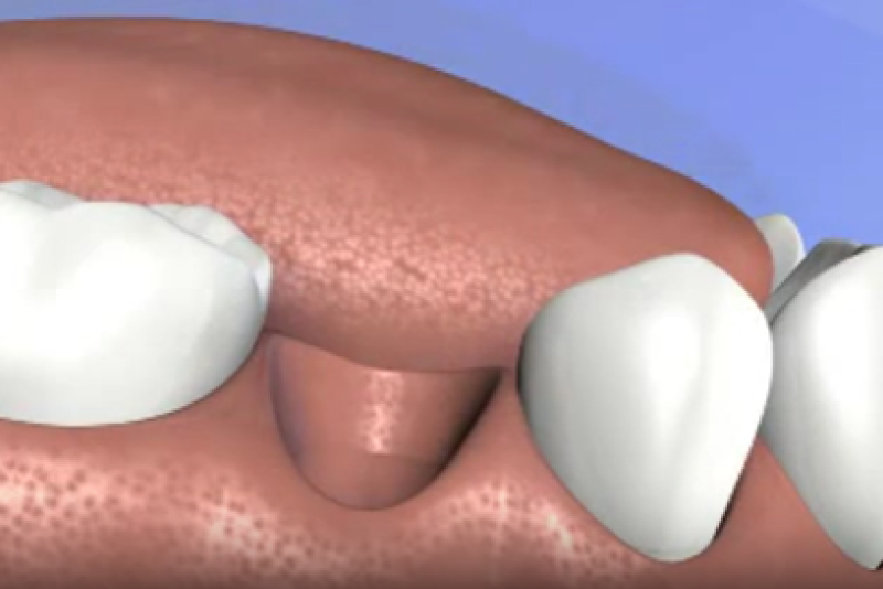 Dental Specialty Group North Toronto North York Kitchener Periodontal