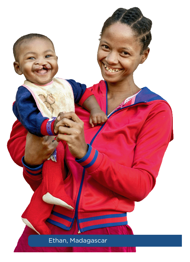 A mother and her child — Operation Smile